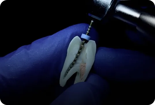 Endodoncie